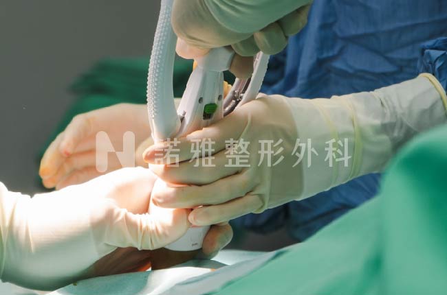 台南諾雅整形外科包皮槍手術