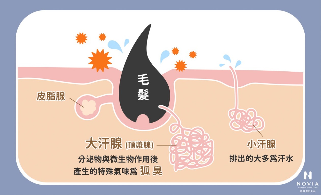 頂漿腺排出的分泌物與微生物作用後，產生難聞的狐臭氣味
