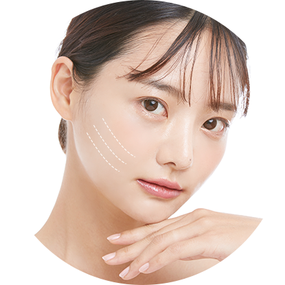 眼袋手術的合併手術：埋線拉提手術