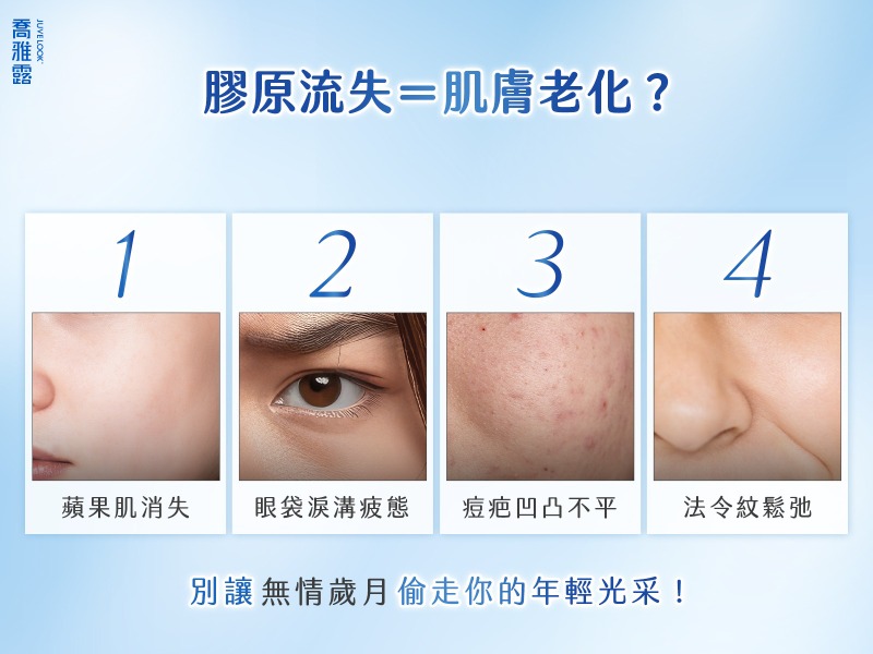 膠原蛋白流失肌膚老化