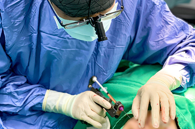 無痕眼袋回填淚溝手術－諾雅整形外科