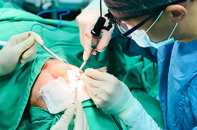 眼袋手術過程－諾雅整形外科