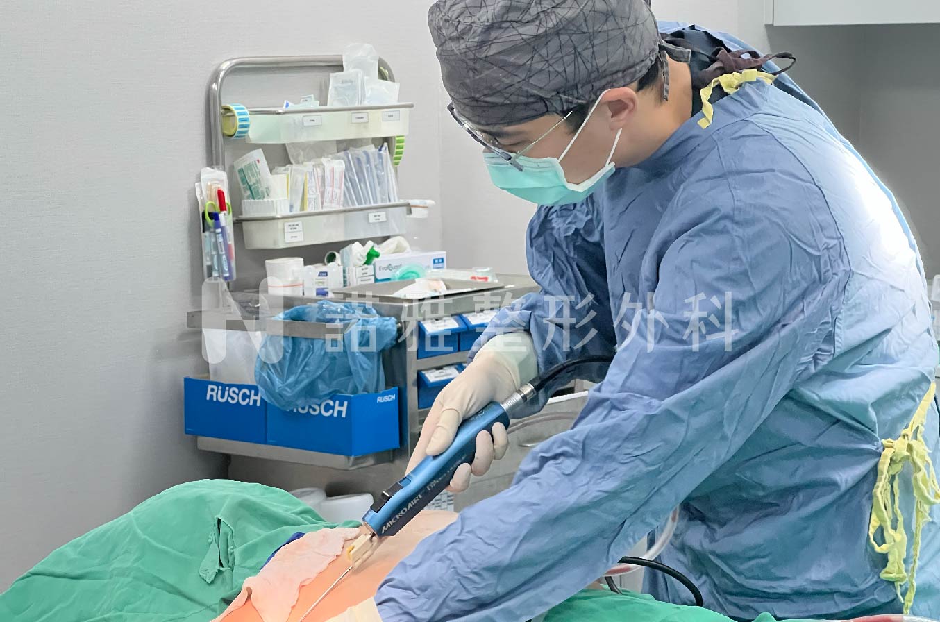 抽脂手術－諾雅整形外科