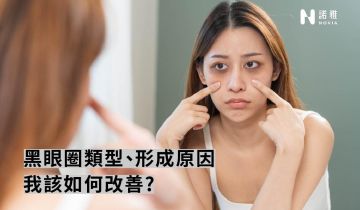 快速改善黑眼圈！醫美專家分析3類成因與對策
