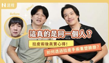【拉皮術後真實心得分享】真的是同個人?做完超後悔?拉皮案例分享🌟張鈞凱醫師|諾雅整形外科