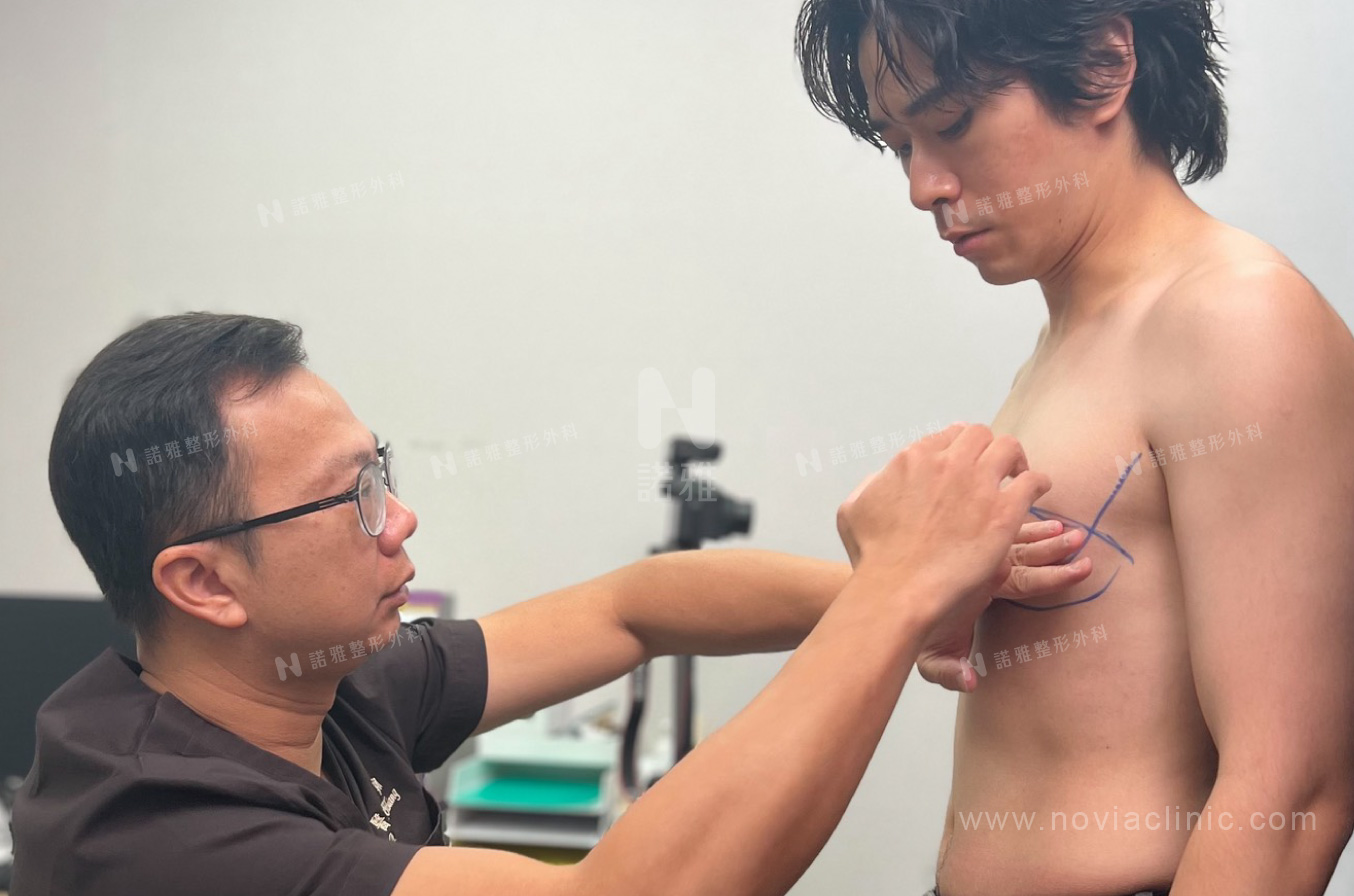 男性女乳症手術術前諮詢